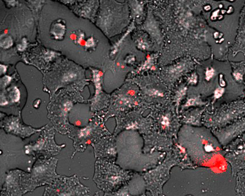 MCF-7 cells incubated with CPNs